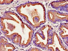 KLK2 / Kallikrein 2 Antibody - Immunohistochemistry image of paraffin-embedded human prostate tissue at a dilution of 1:100