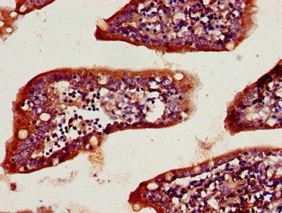 KLK2 / Kallikrein 2 Antibody - Immunohistochemistry image of paraffin-embedded human small intestine tissue at a dilution of 1:100