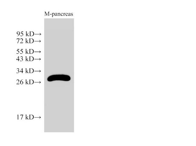 KLK2 / Kallikrein 2 Antibody - Western Blot analysis of Mouse pancreas using KLK2 Ployclonal Antibody at dilution of 1:2000.