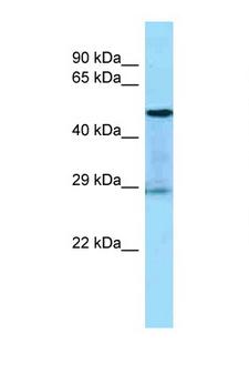 KLK3 / PSA Antibody - KLK3 / PSA antibody Western blot of 1 Cell lysate. Antibody concentration 1 ug/ml.  This image was taken for the unconjugated form of this product. Other forms have not been tested.