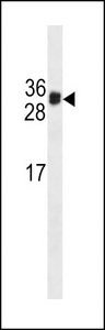 KLK3 / PSA Antibody - HKLK3 Antibody (C234)western blot of MDA-MB231 cell line lysates (35 ug/lane). The HKLK3 antibody detected the HKLK3 protein (arrow).