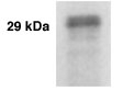 KLK3 / PSA Antibody - KLK 3 (PSA) Antibody - Western blot of KLK3 (also known as PSA) in LNCaP cells using anti-KLK3 at a 1:1,000 dilution