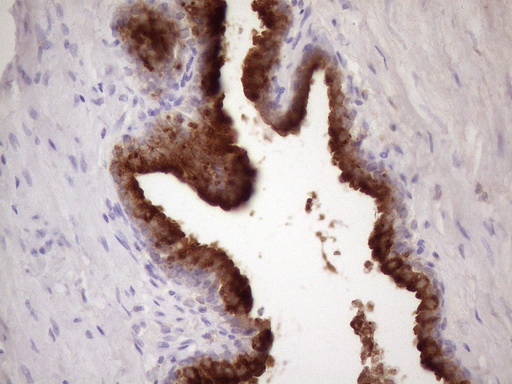 KLK3 / PSA Antibody - Immunohistochemical staining of paraffin-embedded Human prostate tissue within the normal limits using anti-KLK3 mouse monoclonal antibody. (Heat-induced epitope retrieval by 1 mM EDTA in 10mM Tris, pH8.5, 120C for 3min. (1:150)