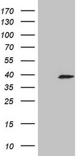 KLK3 / PSA Antibody - HEK293T cells were transfected with the pCMV6-ENTRY control (Left lane) or pCMV6-ENTRY KLK3 (Right lane) cDNA for 48 hrs and lysed. Equivalent amounts of cell lysates (5 ug per lane) were separated by SDS-PAGE and immunoblotted with anti-KLK3 (1:2000).