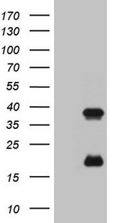 KLK3 / PSA Antibody - HEK293T cells were transfected with the pCMV6-ENTRY control. (Left lane) or pCMV6-ENTRY KLK3. (Right lane) cDNA for 48 hrs and lysed. Equivalent amounts of cell lysates. (5 ug per lane) were separated by SDS-PAGE and immunoblotted with anti-KLK3. (1:2000)