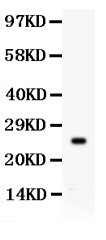 KLK3 / PSA Antibody - PSA antibody Western blot. All lanes: Anti PSA at 0.5 ug/ml. WB: Recombinant Human PSA Protein 0.5ng. Predicted band size: 25 kD. Observed band size: 25 kD.