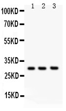 KLK3 / PSA Antibody - PSA antibody Western blot. All lanes: Anti PSA at 0.5 ug/ml. Lane 1: Rat Brain Tissue Lysate at 50 ug. Lane 2: Rat Kidney Tissue Lysate at 50 ug. Lane 3: Human Placenta Tissue Lysate at 50 ug. Predicted band size: 29 kD. Observed band size: 29 kD.