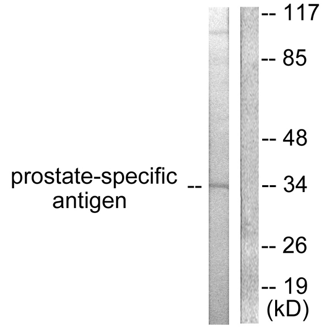 KLK3 / PSA Antibody - Western blot analysis of lysates from mouse heart cells, using Prostate-specific Antigen Antibody. The lane on the right is blocked with the synthesized peptide.