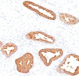 KLK3 / PSA Antibody - Prostate Specific Antigen PSA antibody immunohistochemistry.  This image was taken for the unmodified form of this product. Other forms have not been tested.