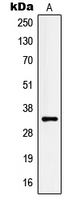 KLK3 / PSA Antibody - Western blot analysis of Kallikrein 3 expression in LNCaP (A) whole cell lysates.