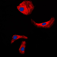 KLK3 / PSA Antibody - Immunofluorescent analysis of Kallikrein 3 staining in LNCaP cells. Formalin-fixed cells were permeabilized with 0.1% Triton X-100 in TBS for 5-10 minutes and blocked with 3% BSA-PBS for 30 minutes at room temperature. Cells were probed with the primary antibody in 3% BSA-PBS and incubated overnight at 4 C in a humidified chamber. Cells were washed with PBST and incubated with a DyLight 594-conjugated secondary antibody (red) in PBS at room temperature in the dark. DAPI was used to stain the cell nuclei (blue).
