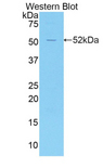 KLK4 / Kallikrein 4 Antibody - Western blot of recombinant KLK4 / Kallikrein 4.  This image was taken for the unconjugated form of this product. Other forms have not been tested.