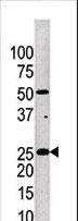 KLK4 / Kallikrein 4 Antibody - Western blot of anti-KLK4 antibody in mouse brain tissue lysate.KLK4(arrow) was detected using the purified antibody.