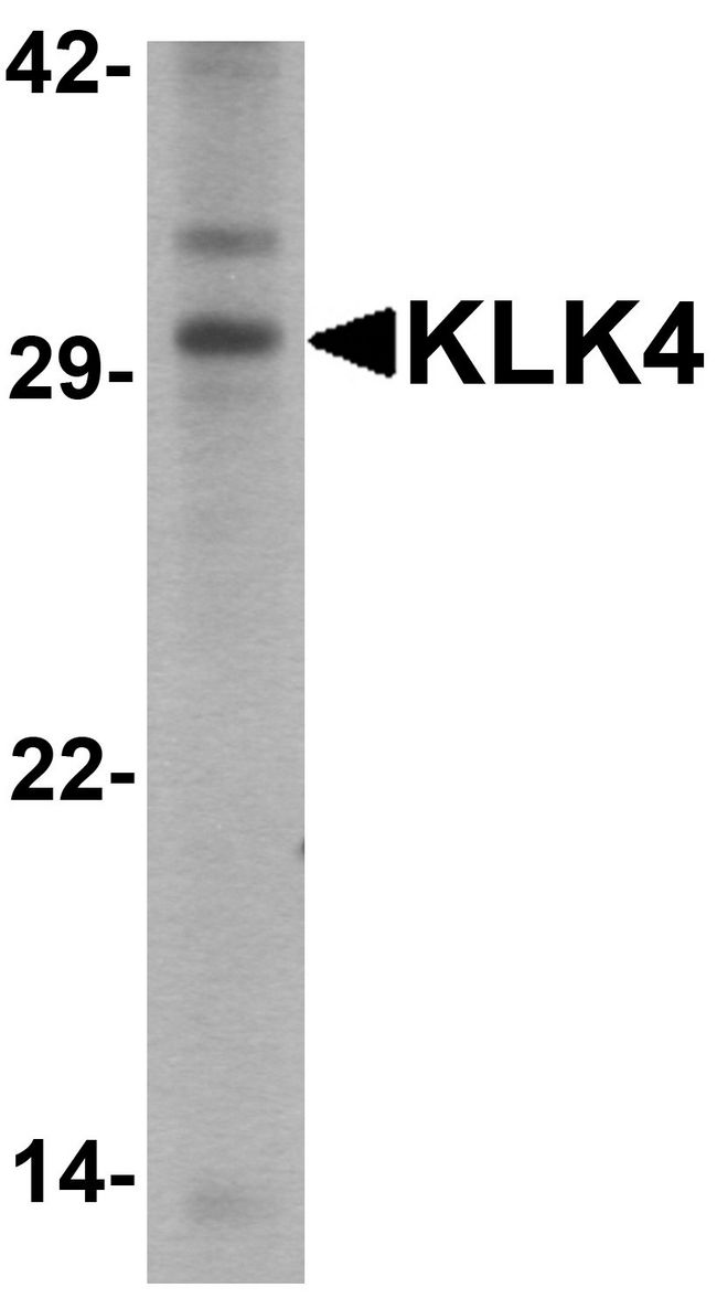KLK4 / Kallikrein 4 Antibody - Western blot analysis of KLK4 in human kidney tissue lysate with KLK4 antibody at 1 ug/ml.