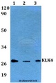 KLK4 / Kallikrein 4 Antibody - Western blot of KLK4 antibody at 1:500 dilution. Lane 1: A549 whole cell lysate. Lane 2: sp2/0 whole cell lysate. Lane 3: H9C2 whole cell lysate.