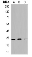 KLK4 / Kallikrein 4 Antibody - Western blot analysis of Kallikrein 4 expression in A549 (A); NS-1 (B); H9C2 (C) whole cell lysates.