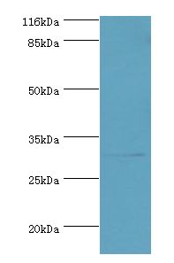 KLK5 / Kallikrein 5 Antibody - Western blot. All lanes: KLK5 antibody at 2 ug/ml+MCF-7 whole cell lysate. Secondary antibody: Goat polyclonal to rabbit at 1:10000 dilution. Predicted band size: 32 kDa. Observed band size: 32 kDa.  This image was taken for the unconjugated form of this product. Other forms have not been tested.