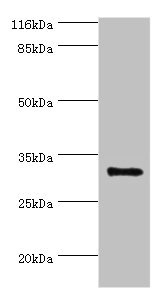 KLK5 / Kallikrein 5 Antibody - Western blot All lanes: KLK5 antibody at 2µg/ml + MCF-7 whole cell lysate Secondary Goat polyclonal to rabbit IgG at 1/10000 dilution Predicted band size: 32 kDa Observed band size: 32 kDa