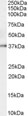 KLK5 / Kallikrein 5 Antibody - Antibody (0.1 ug/ml) staining of Human Prostate lysate (35 ug protein in RIPA buffer). Primary incubation was 1 hour. Detected by chemiluminescence.