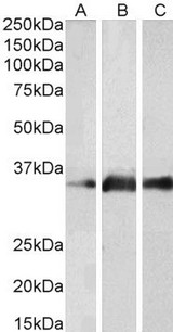 KLK5 / Kallikrein 5 Antibody - Goat Anti-KLK5 Antibody (2µg/ml) staining of Human Brain (Cerebellum) (A), Mouse Brain (B) and Rat Brain (C) lysates (35µg protein in RIPA buffer). Primary incubation was 1 hour. Detected by chemiluminescencence.