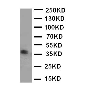KLK5 / Kallikrein 5 Antibody - WB of KLK5 / Kallikrein 5 antibody. WB: Mouse Liver Tissue Lysate.
