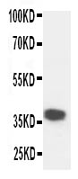 KLK5 / Kallikrein 5 Antibody - Anti-Kallikrein 5 antibody, Western blottingWB: Mouse Liver Tissue Lysate