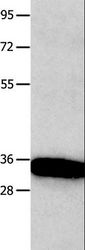 KLK5 / Kallikrein 5 Antibody - Western blot analysis of Mouse brain tissue, using KLK5 Polyclonal Antibody at dilution of 1:1600.
