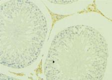 KLK5 / Kallikrein 5 Antibody - 1:100 staining mouse testis tissue by IHC-P. The sample was formaldehyde fixed and a heat mediated antigen retrieval step in citrate buffer was performed. The sample was then blocked and incubated with the antibody for 1.5 hours at 22°C. An HRP conjugated goat anti-rabbit antibody was used as the secondary.