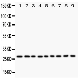 KLK6 / Kallikrein 6 Antibody - Anti-Kallikrein 6 antibody, Western blotting All lanes: Anti Kallikrein 6 at 0.5ug/ml Lane 1: MCF-7 Whole Cell Lysate at 40ug Lane 2: HELA Whole Cell Lysate at 40ug Lane 3: MM231 Whole Cell Lysate at 40ug Lane 4: MM453 Whole Cell Lysate at 40ug Lane 5: A549 Whole Cell Lysate at 40ug Lane 6: SMMC Whole Cell Lysate at 40ug Lane 7: COLO320 Whole Cell Lysate at 40ug Lane 8: SW620 Whole Cell Lysate at 40ug Lane 9: HT1080 Whole Cell Lysate at 40ug Predicted bind size: 27KD Observed bind size: 27KD