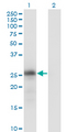 KLK6 / Kallikrein 6 Antibody - Western Blot analysis of KLK6 expression in transfected 293T cell line by KLK6 monoclonal antibody (M01), clone 4A10.Lane 1: KLK6 transfected lysate(26.9 KDa).Lane 2: Non-transfected lysate.