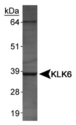 KLK6 / Kallikrein 6 Antibody - KLK6 Antibody - Human salivary lysates.