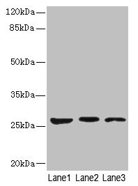 KLK6 / Kallikrein 6 Antibody - Western blot All lanes: KLK6 antibody at 5µg/ml Lane 1: Mouse liver tissue Lane 2: Mouse brain tissue Lane 3: A375 whole cell lysate Secondary Goat polyclonal to rabbit IgG at 1/10000 dilution Predicted band size: 27, 16, 5 kDa Observed band size: 27 kDa