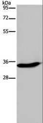 KLK6 / Kallikrein 6 Antibody - Western blot analysis of A375 cell, using KLK6 Polyclonal Antibody at dilution of 1:300.