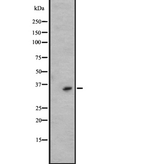 KLK6 / Kallikrein 6 Antibody - Western blot analysis of KLK6 expression in A431 whole cells lysate. The lane on the left is treated with the antigen-specific peptide.