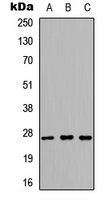 KLK6 / Kallikrein 6 Antibody - Western blot analysis of Kallikrein 6 expression in HEK293T (A); NS-1 (B); PC12 (C) whole cell lysates.
