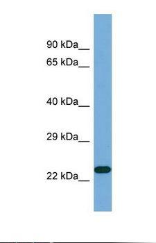 KLK7 / Kallikrein 7 Antibody - Western blot of Human Fetal Brain . KLK7 antibody dilution 1.0 ug/ml.  This image was taken for the unconjugated form of this product. Other forms have not been tested.