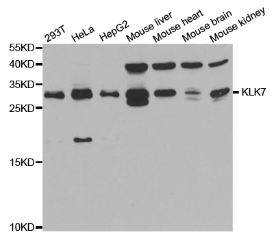 KLK7 / Kallikrein 7 Antibody - Western blot analysis of extracts of various cell lines.