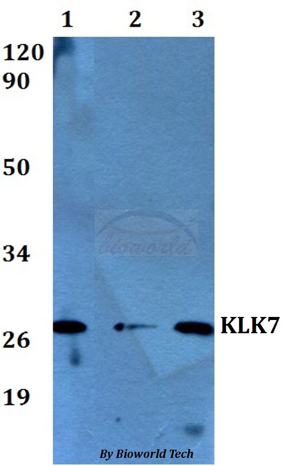 KLK7 / Kallikrein 7 Antibody - Western blot of KLK7 antibody at 1:500 dilution. Lane 1: HEK293T whole cell lysate. Lane 2: sp2/0 whole cell lysate. Lane 3: PC12 whole cell lysate.