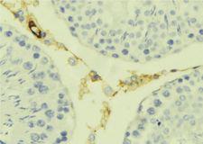 KLK7 / Kallikrein 7 Antibody - 1:100 staining mouse testis tissue by IHC-P. The sample was formaldehyde fixed and a heat mediated antigen retrieval step in citrate buffer was performed. The sample was then blocked and incubated with the antibody for 1.5 hours at 22°C. An HRP conjugated goat anti-rabbit antibody was used as the secondary.