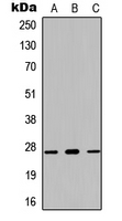 KLK7 / Kallikrein 7 Antibody - Western blot analysis of Kallikrein 7 expression in HEK293T (A); NS-1 (B); PC12 (C) whole cell lysates.