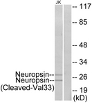 KLK8 / Kallikrein 8 Antibody - Western blot of extracts from Jurkat cells, treated with etoposide 25 uM 24h, using Neuropsin (Cleaved-Val33) Antibody. The lane on the right is treated with the synthesized peptide.