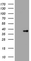 KLK8 / Kallikrein 8 Antibody - HEK293T cells were transfected with the pCMV6-ENTRY control (Left lane) or pCMV6-ENTRY KLK8 (Right lane) cDNA for 48 hrs and lysed. Equivalent amounts of cell lysates (5 ug per lane) were separated by SDS-PAGE and immunoblotted with anti-KLK8.