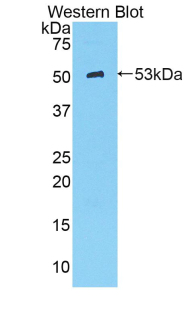 KLK8 / Kallikrein 8 Antibody - Western blot of recombinant KLK8 / Kallikrein 8.  This image was taken for the unconjugated form of this product. Other forms have not been tested.
