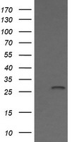 KLK8 / Kallikrein 8 Antibody - HEK293T cells were transfected with the pCMV6-ENTRY control (Left lane) or pCMV6-ENTRY KLK8 (Right lane) cDNA for 48 hrs and lysed. Equivalent amounts of cell lysates (5 ug per lane) were separated by SDS-PAGE and immunoblotted with anti-KLK8.