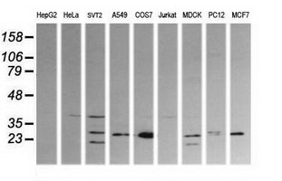 KLK8 / Kallikrein 8 Antibody - Western blot of extracts (35ug) from 9 different cell lines by using anti-KLK8 monoclonal antibody (HepG2: human; HeLa: human; SVT2: mouse; A549: human; COS7: monkey; Jurkat: human; MDCK: canine; PC12: rat; MCF7: human).