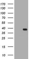 KLK8 / Kallikrein 8 Antibody - HEK293T cells were transfected with the pCMV6-ENTRY control (Left lane) or pCMV6-ENTRY KLK8 (Right lane) cDNA for 48 hrs and lysed. Equivalent amounts of cell lysates (5 ug per lane) were separated by SDS-PAGE and immunoblotted with anti-KLK8.