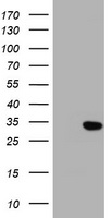 KLK8 / Kallikrein 8 Antibody - HEK293T cells were transfected with the pCMV6-ENTRY control (Left lane) or pCMV6-ENTRY KLK8 (Right lane) cDNA for 48 hrs and lysed. Equivalent amounts of cell lysates (5 ug per lane) were separated by SDS-PAGE and immunoblotted with anti-KLK8.