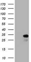 KLK8 / Kallikrein 8 Antibody - HEK293T cells were transfected with the pCMV6-ENTRY control (Left lane) or pCMV6-ENTRY KLK8 (Right lane) cDNA for 48 hrs and lysed. Equivalent amounts of cell lysates (5 ug per lane) were separated by SDS-PAGE and immunoblotted with anti-KLK8.