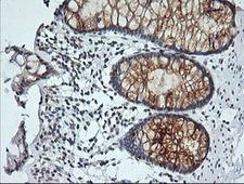 KLK8 / Kallikrein 8 Antibody - IHC of paraffin-embedded Human colon tissue using anti-KLK8 mouse monoclonal antibody.