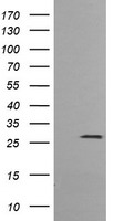 KLK8 / Kallikrein 8 Antibody - HEK293T cells were transfected with the pCMV6-ENTRY control (Left lane) or pCMV6-ENTRY KLK8 (Right lane) cDNA for 48 hrs and lysed. Equivalent amounts of cell lysates (5 ug per lane) were separated by SDS-PAGE and immunoblotted with anti-KLK8.